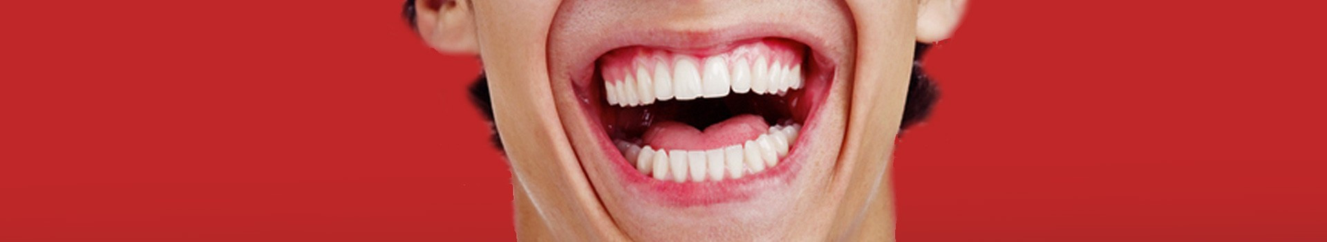 Ridere Ridere Ridere